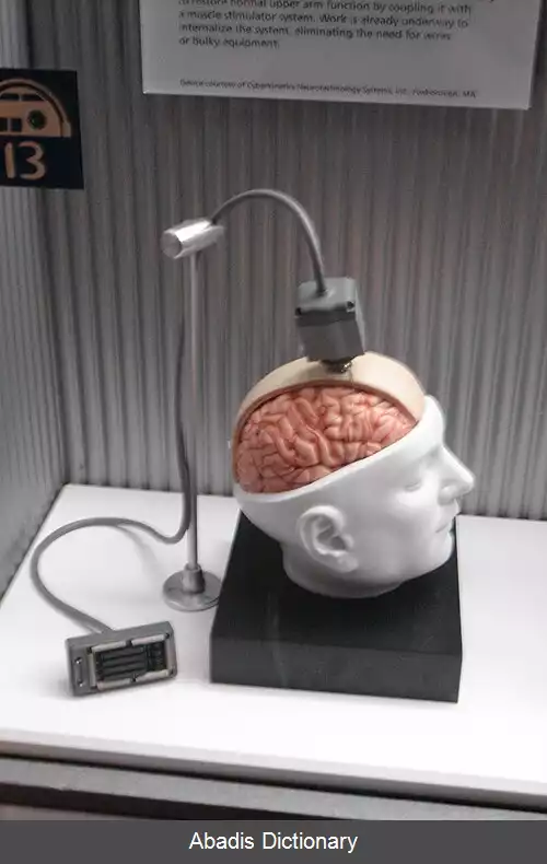 عکس واسط مغز و رایانه