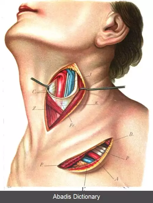 عکس سرخرگ تیروئیدی زبرین