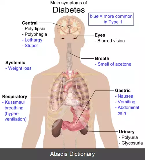 عکس دیابت نوع ۱