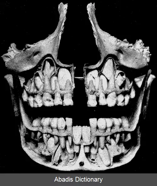 عکس دندان نیش (پستانداران)