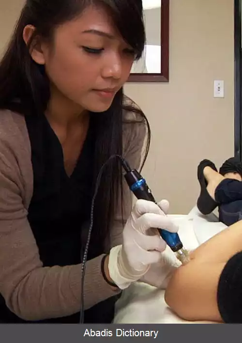 عکس میکرونیدلینگ