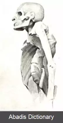 عکس بیماری پات