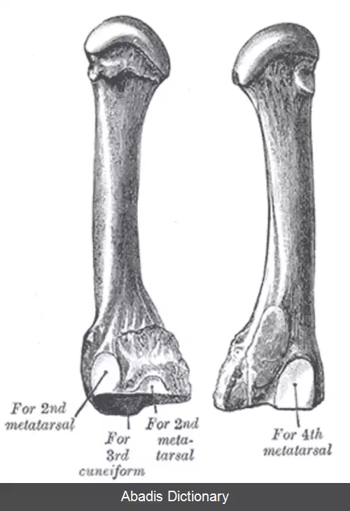 عکس استخوان کف پایی سوم