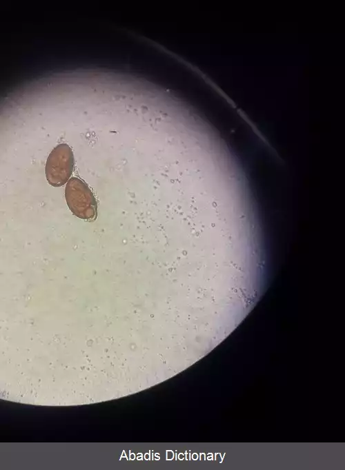 عکس کپلک جگر نیشتری