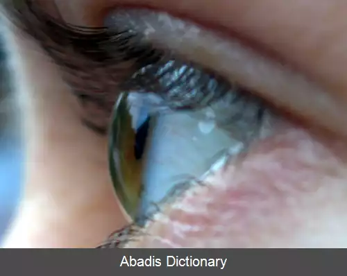 عکس فیزیولوژی دستگاه بینایی